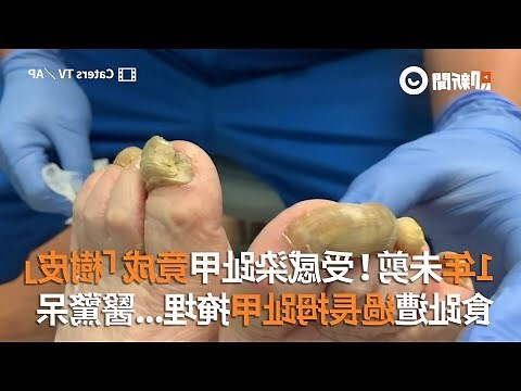 留小拇指指甲 意思